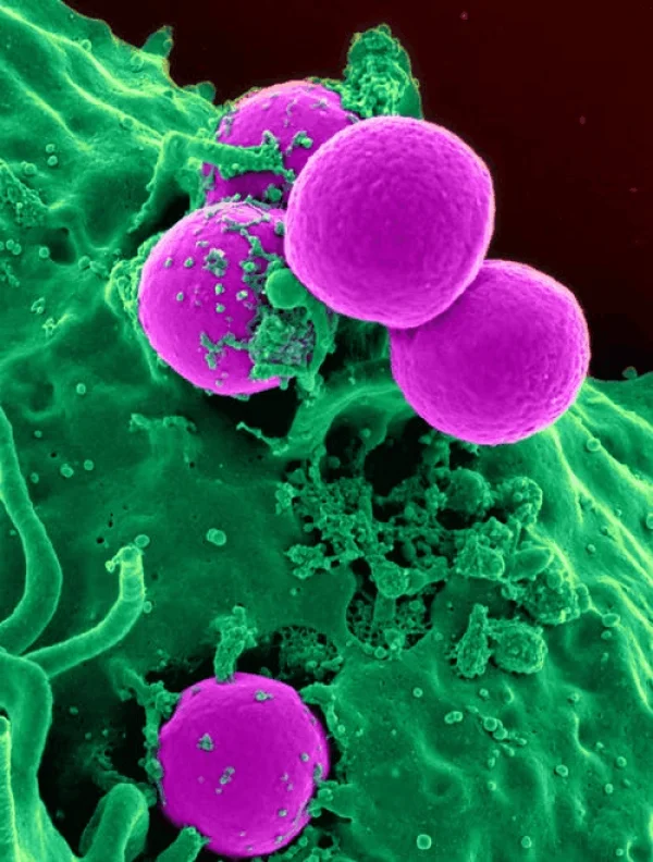 What You Need to Know About Candida