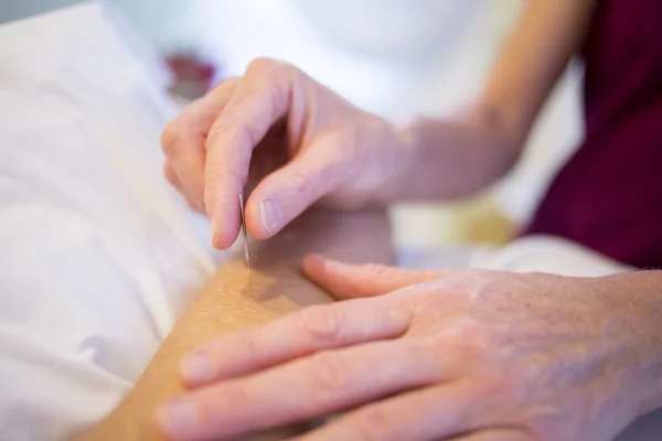 How safe is acupuncture?