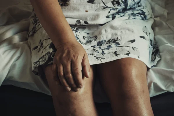 Nutrition and Rheumatoid Arthritis