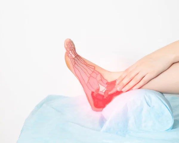 What Causes Stress Fractures and How to Treat Them