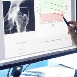 Bone density screening
