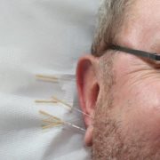 Needles in your ear can help your health…